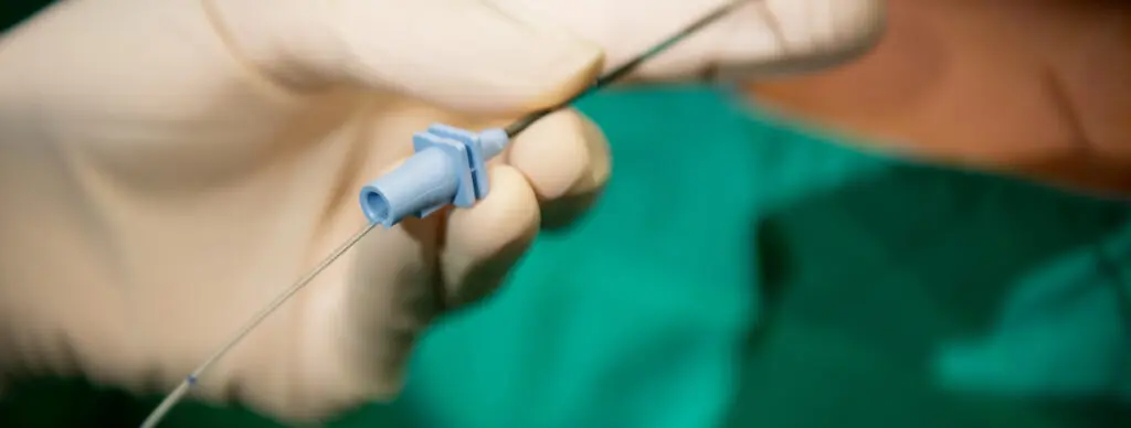 Qué es una inyección epidural transforaminal