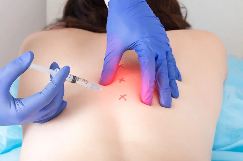 How Trigger Point Injections Can Help Relieve Chronic Neck and Back Pain