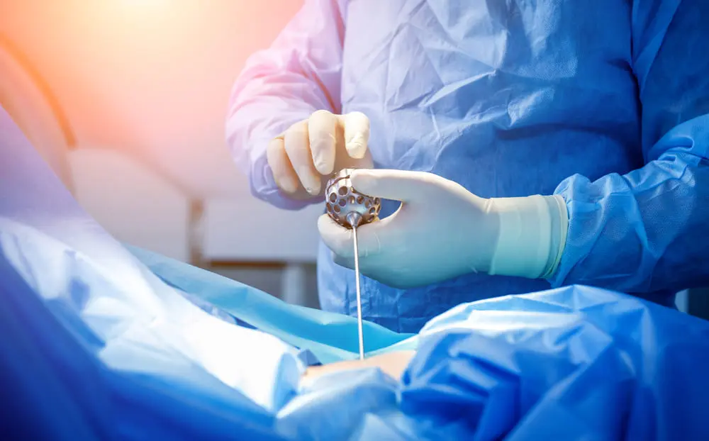 Endoscopic Spine Surgery
