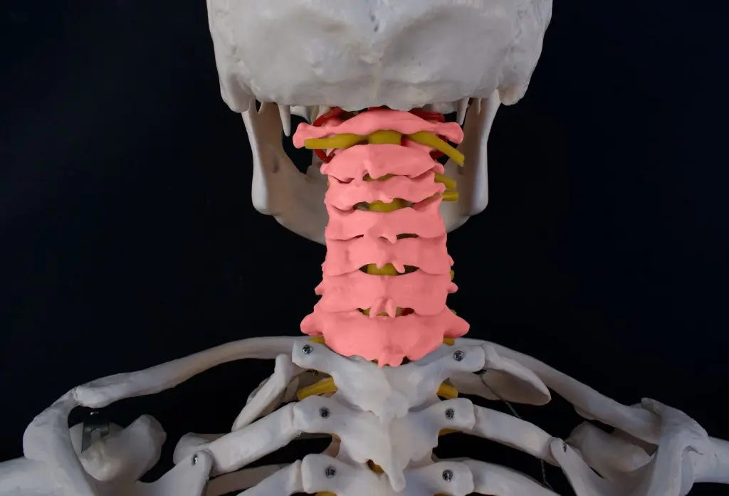 Cervical Posterior Foraminotomy