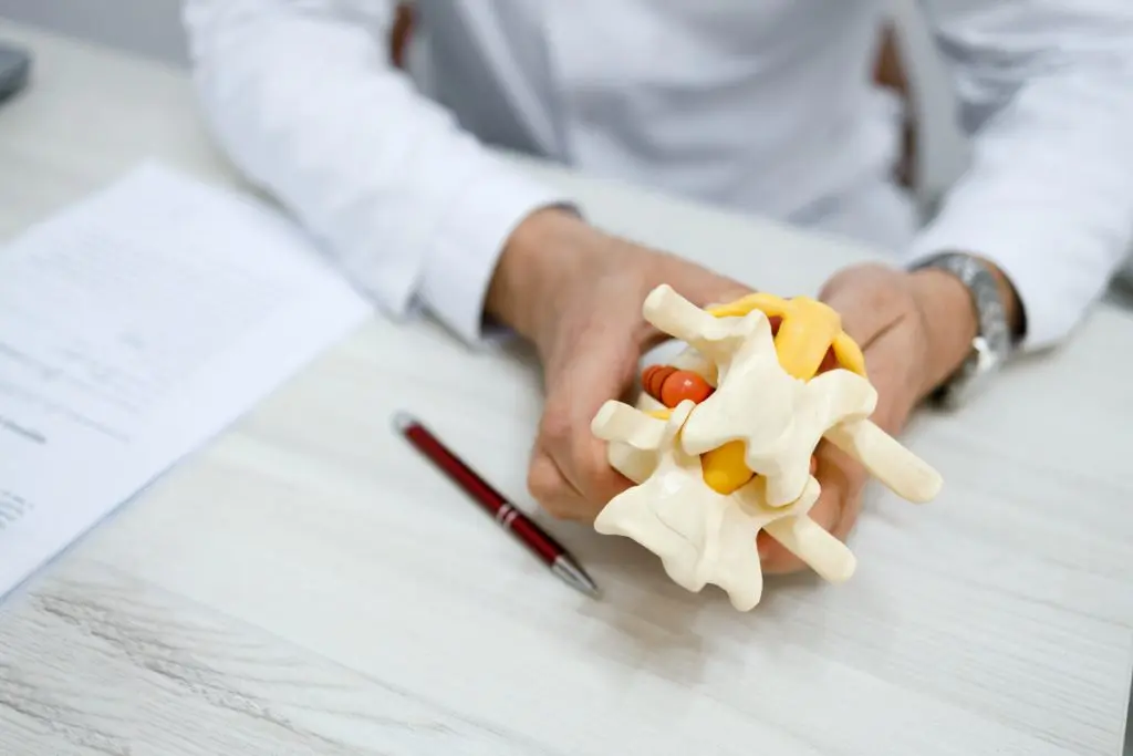 Primer plano de un médico que sostiene en sus manos un modelo de disco lumbar de la columna vertebral con una hernia.