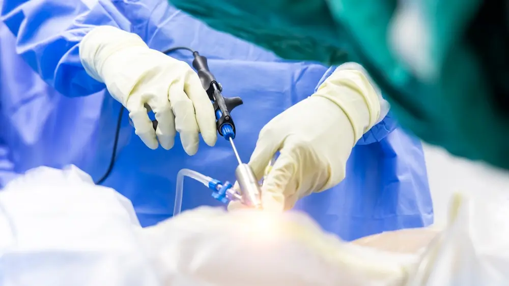 Micro Endoscopic Discectomy