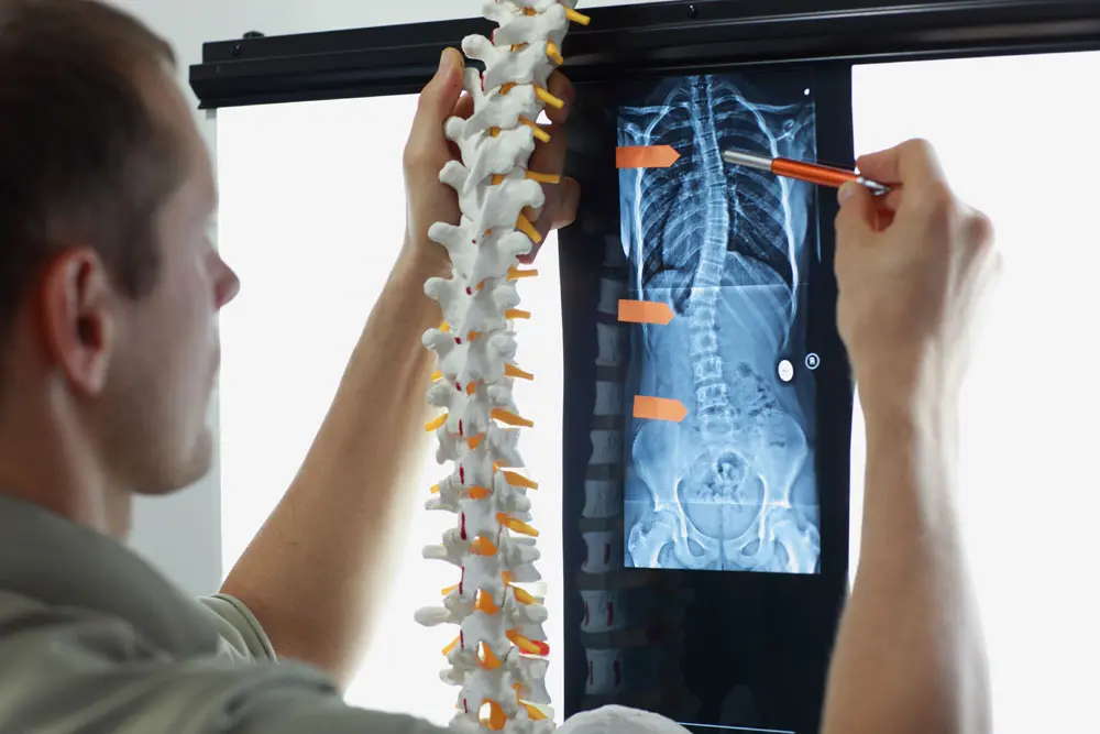 model of spine