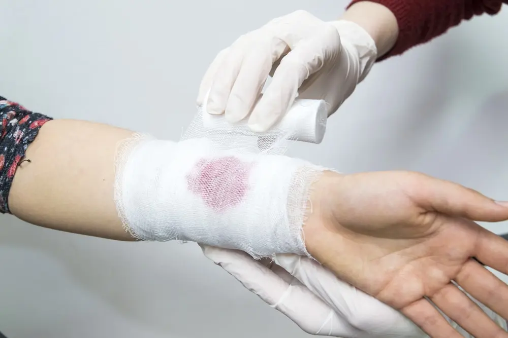 woman getting a cut wrapped after a car accident