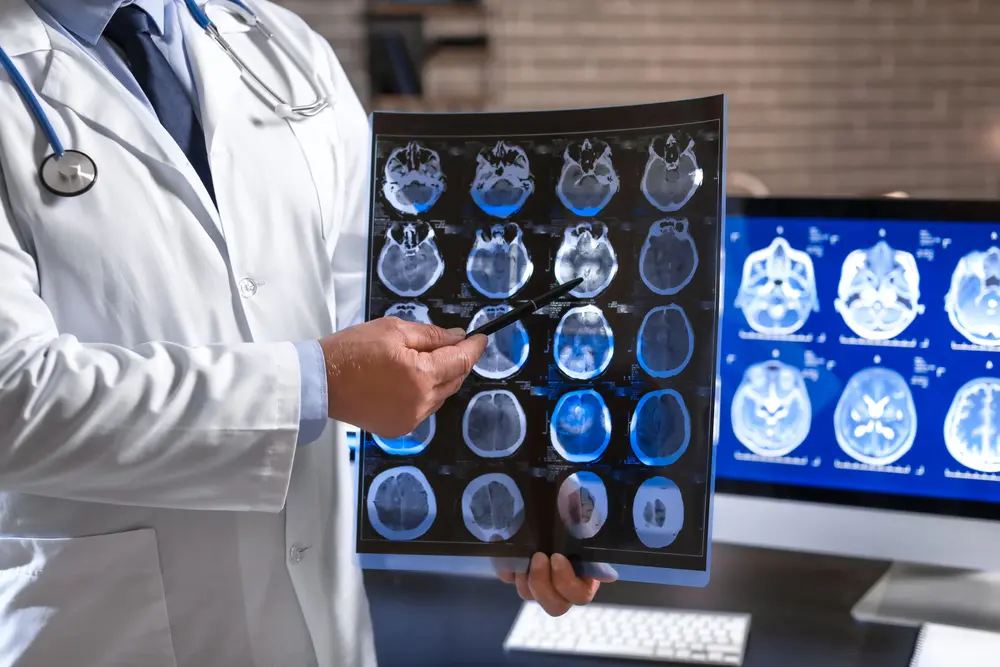 Patient undergoing brain scan after skull injury