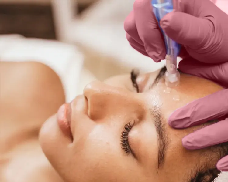 Gloved hands using a skin treatment device on a client's brow