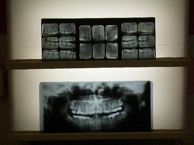xray2