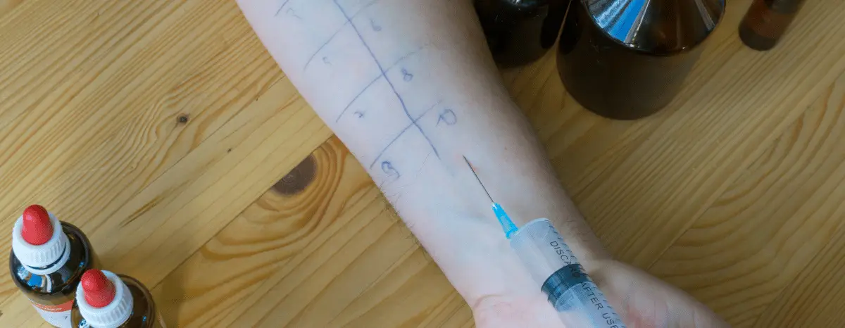 Allergy-Testing copy